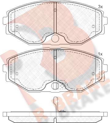 R Brake RB1569 - Kit de plaquettes de frein, frein à disque cwaw.fr